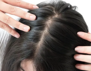 How Can I Get My Hair To Stop Thinning?